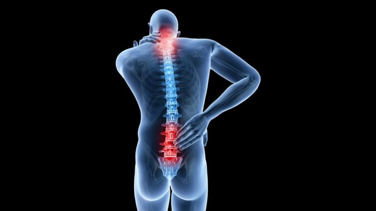 Why Apollo Spine Care is the Ultimate Solution for Back Pain Relief